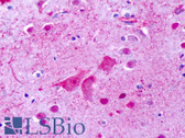 Anti-GPR137 Antibody (Cytoplasmic Domain) IHC-plus LS-A2053