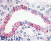 Anti-ESRRG / ERR Gamma Antibody (N-Terminus) IHC-plus LS-A2400