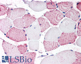 Anti-GPRC6A Antibody (N-Terminus) IHC-plus LS-A2581