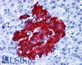 Anti-GPR82 Antibody (Cytoplasmic Domain) IHC-plus LS-A2715