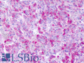 Anti-GPR139 Antibody (Cytoplasmic Domain) IHC-plus LS-A2716