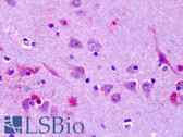 Anti-OR6N1 Antibody (Extracellular Domain) IHC-plus LS-A3228