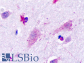 Anti-HRH3 / Histamine 3 Receptor Antibody (Cytoplasmic Domain) IHC-plus LS-A3262