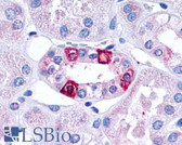Anti-HTR1F / 5-HT1F Receptor Antibody (Cytoplasmic Domain) IHC-plus LS-A3344