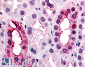 Anti-V1RL1 / VN1R1 Antibody (Extracellular Domain) IHC-plus LS-A3460