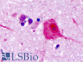 Anti-V1RL1 / VN1R1 Antibody (Extracellular Domain) IHC-plus LS-A3461