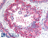 Anti-V1RL1 / VN1R1 Antibody (C-Terminus) IHC-plus LS-A3462