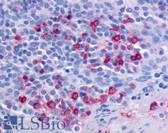Anti-CCR6 Antibody (Extracellular Domain) IHC-plus LS-A356