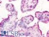 Anti-ACKR2 / CCR10 / D6 Antibody (N-Terminus) IHC-plus LS-A363