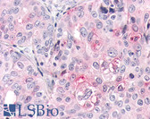 Anti-OR2A4 Antibody (Extracellular Domain) IHC-plus LS-A3903