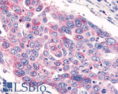 Anti-GPR26 Antibody (Cytoplasmic Domain) IHC-plus LS-A4112