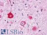 Anti-GPR151 Antibody (Cytoplasmic Domain) IHC-plus LS-A415