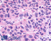 Anti-GPR78 Antibody (Cytoplasmic Domain) IHC-plus LS-A443