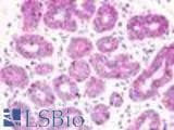 Anti-GPR52 Antibody (N-Terminus) IHC-plus LS-A446