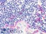 Anti-CHEMR23 / CMKLR1 Antibody (N-Terminus) IHC-plus LS-A447