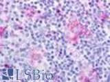 Anti-CHEMR23 / CMKLR1 Antibody (N-Terminus) IHC-plus LS-A448