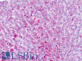 Anti-FZD6 / Frizzled 6 Antibody (N-Terminus) IHC-plus LS-A4481