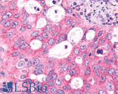 Anti-FZD6 / Frizzled 6 Antibody (N-Terminus) IHC-plus LS-A4482
