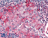 Anti-OR10R2 Antibody (Extracellular Domain) IHC-plus LS-A4554