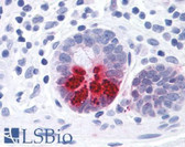 Anti-Prostaglandin D2 Receptor Antibody (N-Terminus) IHC-plus LS-A458