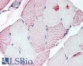 Anti-RXFP2 / LGR8 Antibody (C-Terminus) IHC-plus LS-A4752