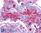 Anti-RXFP2 / LGR8 Antibody (Cytoplasmic Domain) IHC-plus LS-A4753