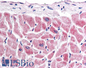 Anti-FZD7 / Frizzled 7 Antibody (C-Terminus) IHC-plus LS-A4897
