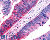Anti-FZD7 / Frizzled 7 Antibody (N-Terminus) IHC-plus LS-A4899