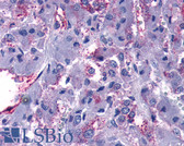 Anti-GPR108 Antibody (Cytoplasmic Domain) IHC-plus LS-A4985