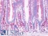 Anti-Prostaglandin D2 Receptor Antibody (Cytoplasmic Domain) IHC-plus LS-A503