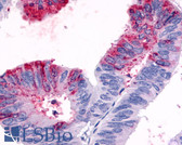 Anti-GPR119 Antibody (Cytoplasmic Domain) IHC-plus LS-A548