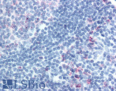 Anti-CELSR1 Antibody (Extracellular Domain) IHC-plus LS-A5624