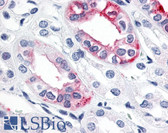 Anti-ESRRG / ERR Gamma Antibody (C-Terminus) IHC-plus LS-A5960