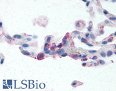 Anti-ADGRE2 / EMR2 Antibody (N-Terminus) IHC-plus LS-A6306