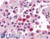Anti-ADGRE2 / EMR2 Antibody (N-Terminus) IHC-plus LS-A6319