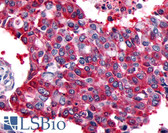 Anti-CALCRL  / CGRP Receptor Antibody (Cytoplasmic Domain) IHC-plus LS-A6731