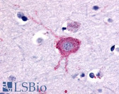 Anti-GRM2 / MGLUR2 Antibody (N-Terminus) IHC-plus LS-A6735