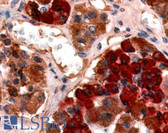 Anti-GHRHR Antibody (Cytoplasmic Domain) IHC-plus LS-A835