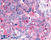Anti-GHRHR Antibody (C-Terminus) IHC-plus LS-A836