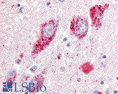 Anti-GPR20 Antibody (N-Terminus) IHC-plus LS-A102