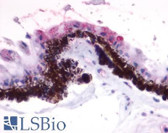 Anti-RGR Antibody (Extracellular Domain) IHC-plus LS-A1043