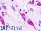 Anti-GPR22 Antibody (N-Terminus) IHC-plus LS-A109