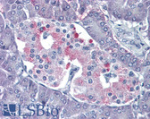 Anti-P2RY4 / P2Y4 Antibody (Internal) IHC-plus LS-A1145