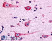 Anti-DRD2 / Dopamine Receptor D2 Antibody (Cytoplasmic Domain) IHC-plus LS-A1403