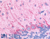 Anti-DRD5 / Dopamine Receptor D5 Antibody (Extracellular Domain) IHC-plus LS-A1407
