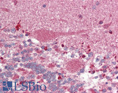 Anti-GPR88 Antibody (Internal) IHC-plus LS-A1571