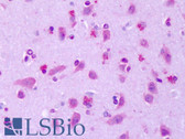 Anti-GPR75 Antibody (Extracellular Domain) IHC-plus LS-A1590