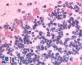 Anti-GPR89A Antibody (Cytoplasmic Domain) IHC-plus LS-A1733