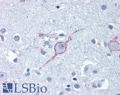 Anti-GALR3 / Galanin Receptor 3 Antibody (Extracellular Domain) IHC-plus LS-A203