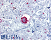 Anti-BRS3 Antibody (C-Terminus) IHC-plus LS-A2288